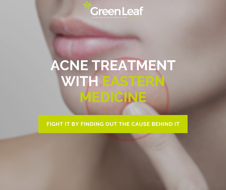 acne treatment, eastern medicine, green leaf clinic, acupuncture, herbal medicine