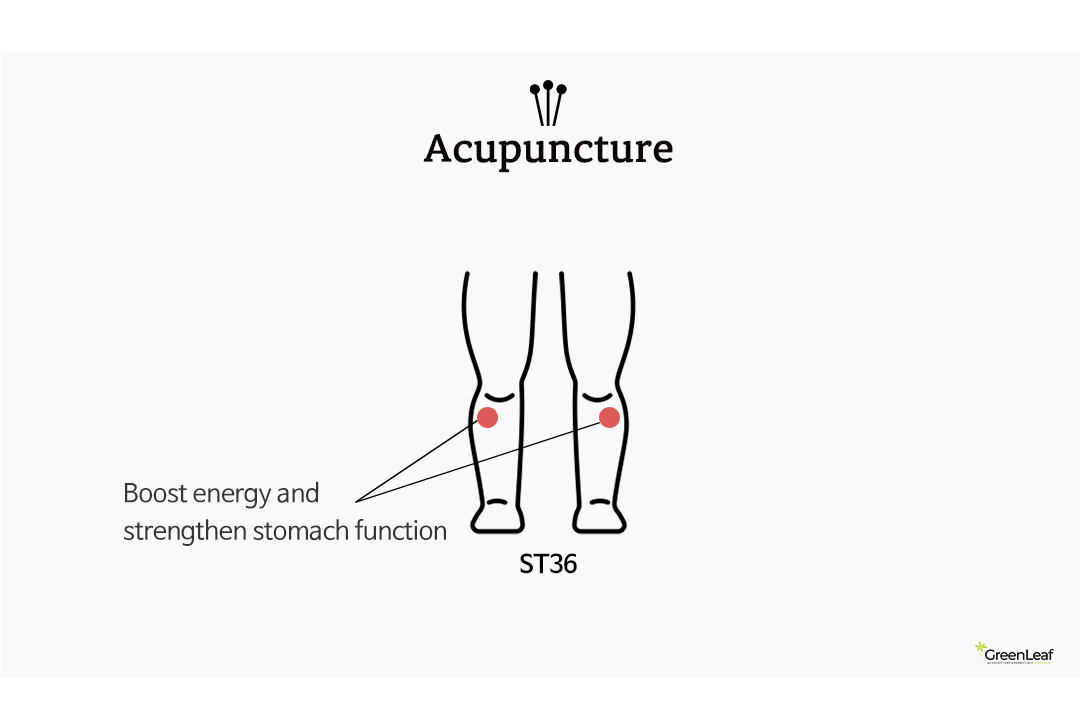 Acupucture ST36