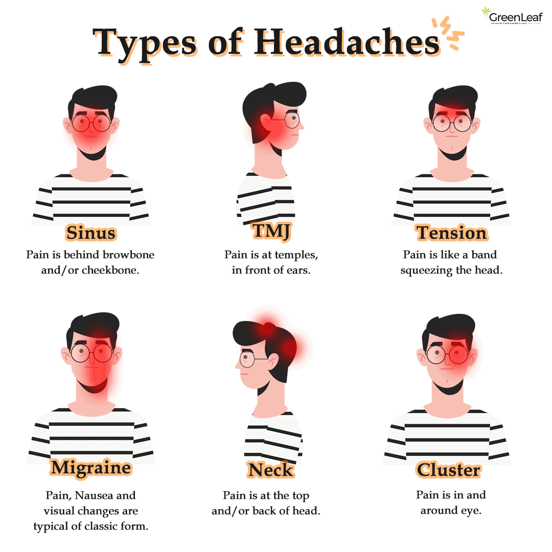 Types of Headache - Image