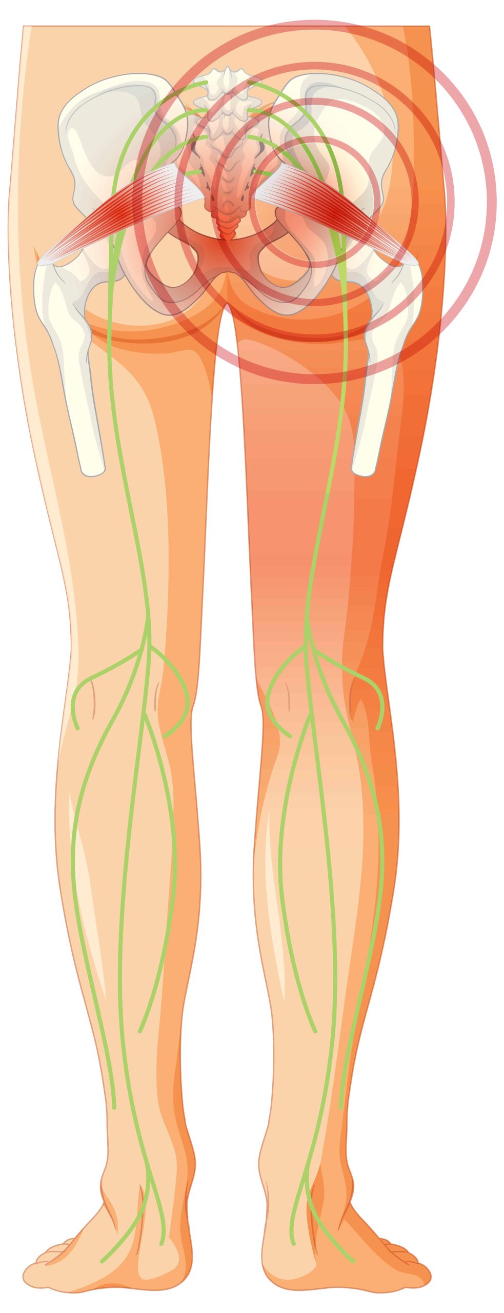 Backpain Image